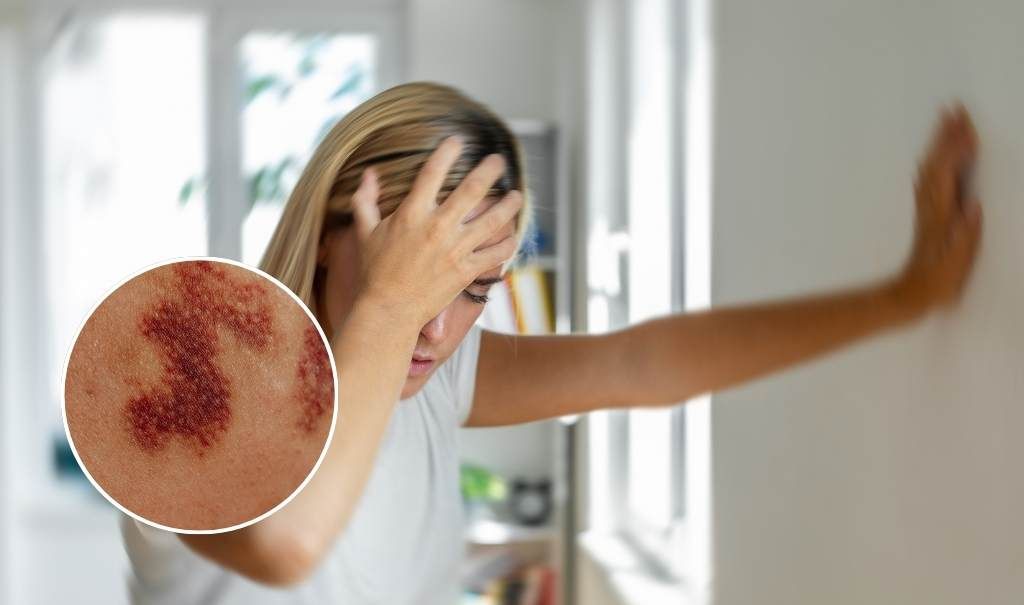 Meningitis in England: History, Risk and the Current Threat